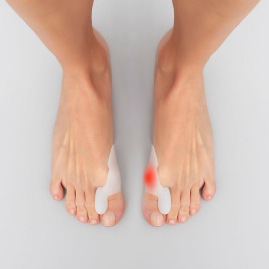 Innovagoods Silicone Bunion Corrector Protector Bunilief Innovagoods 2 Units